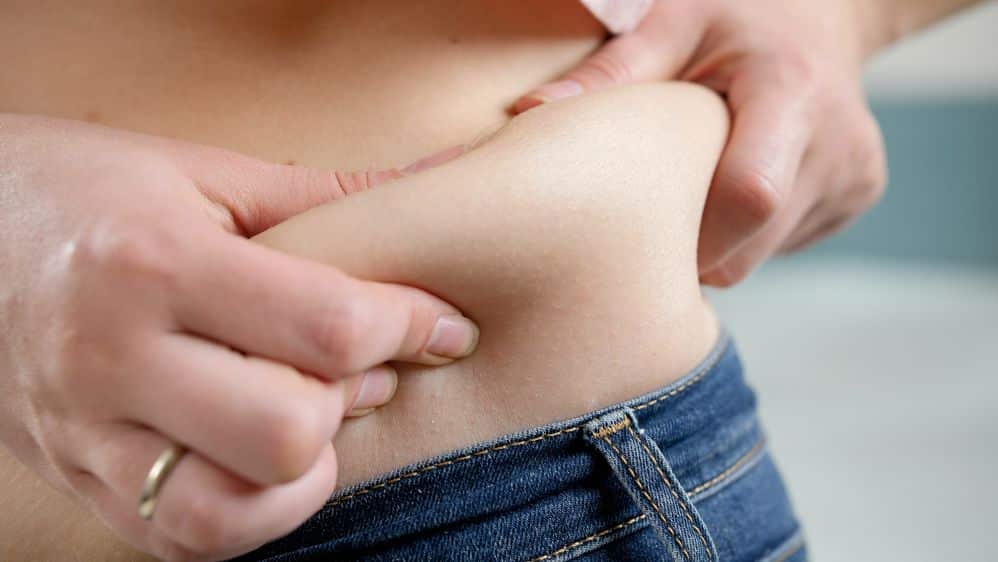 Abdominoplastia
