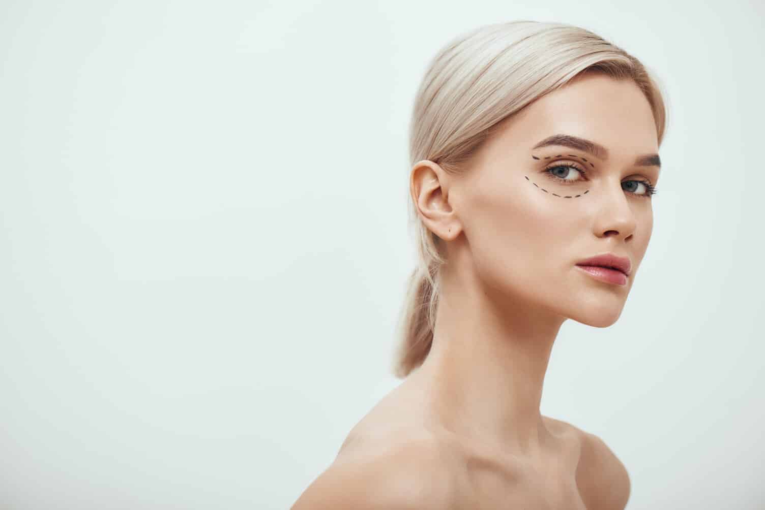 Blefaroplastia - Cirugía de párpados