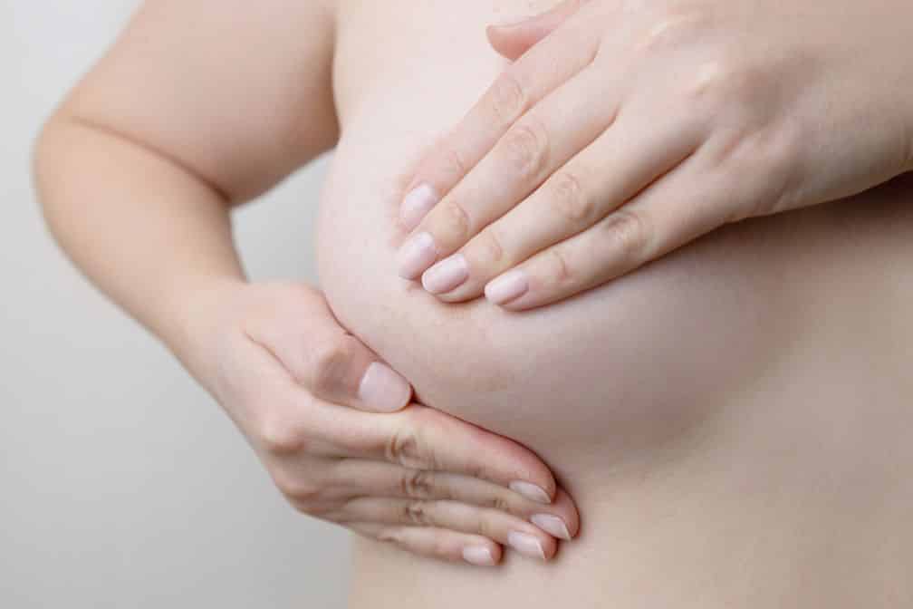 breast augmentation