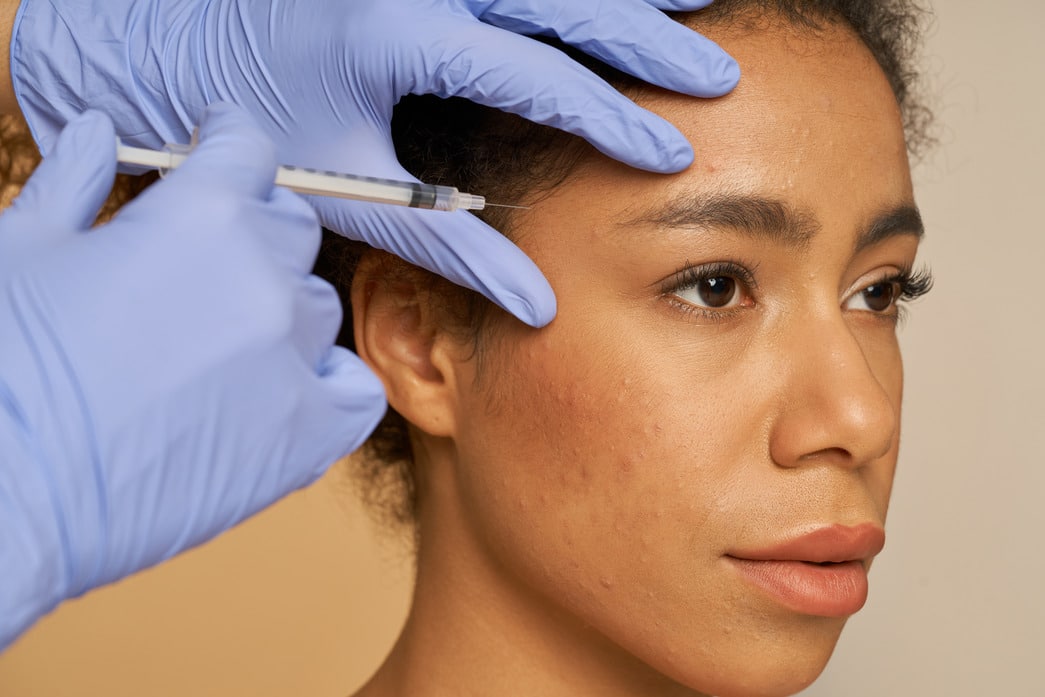 Brow Lift Surgery