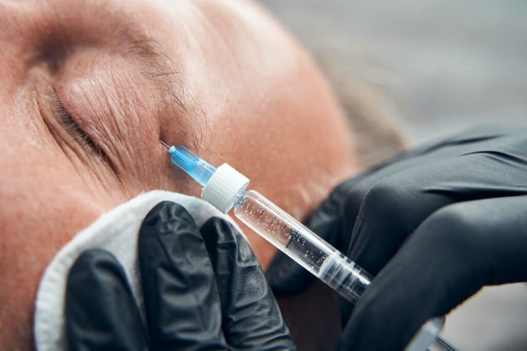blefaroplastia